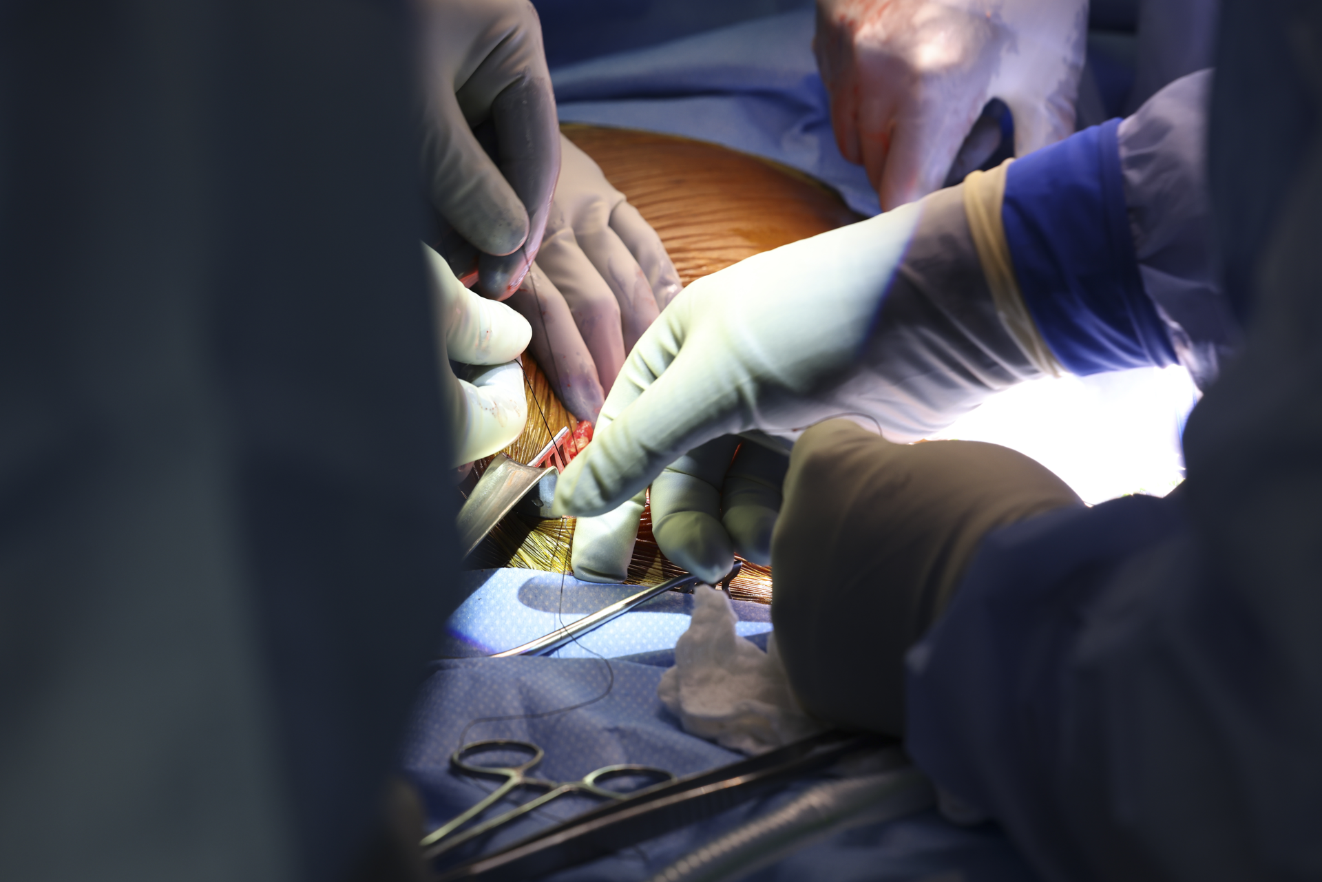 ACS Fellows Successfully Transplant Porcine Kidney into Patient