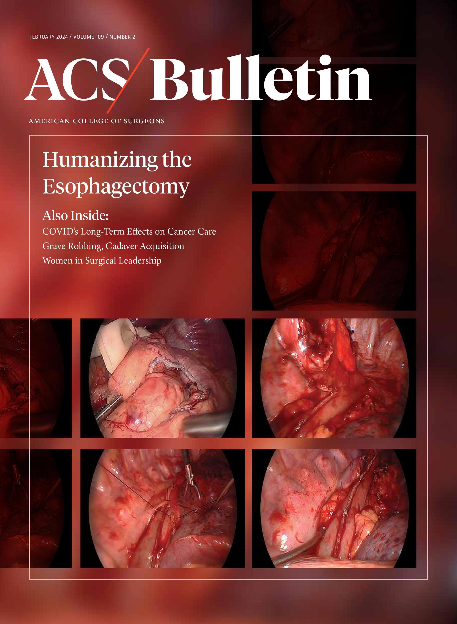 Add Printed Bulletin Option to Your ACS Subscriptions