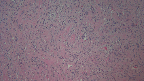 A. 10x magnification