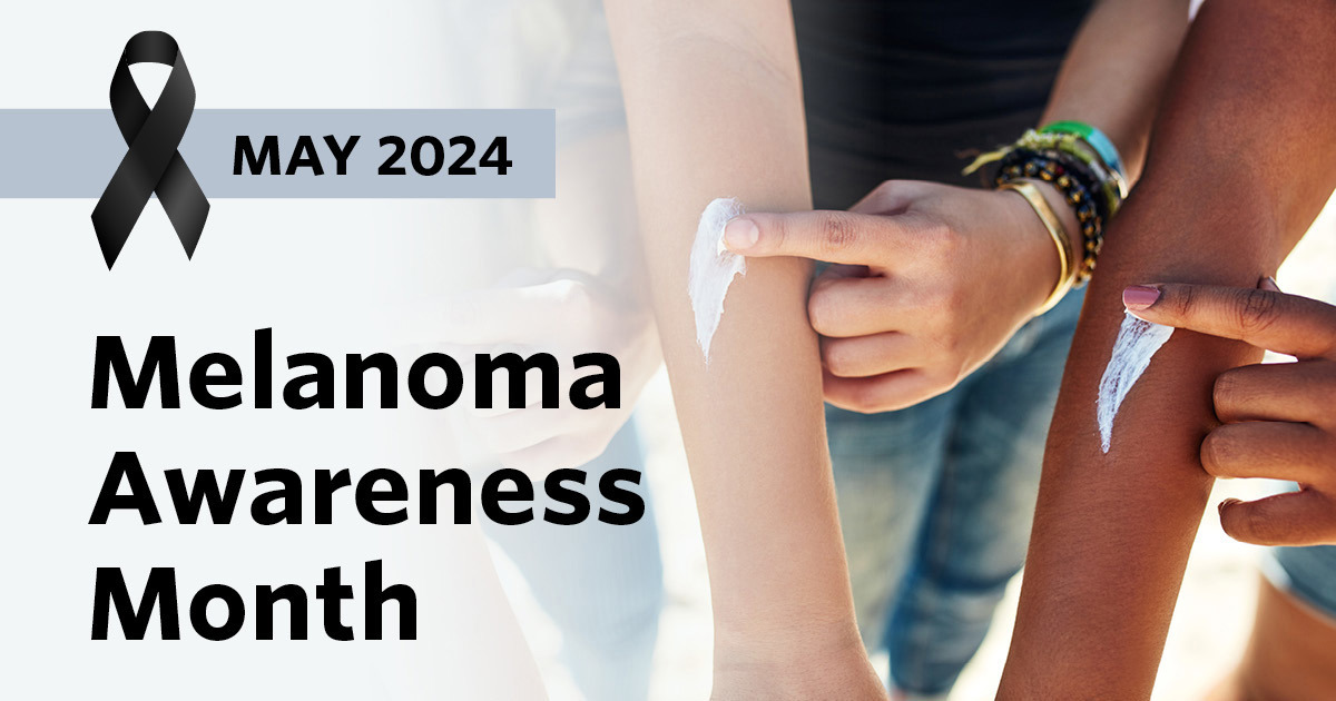 Promote Melanoma Awareness Month in May | ACS