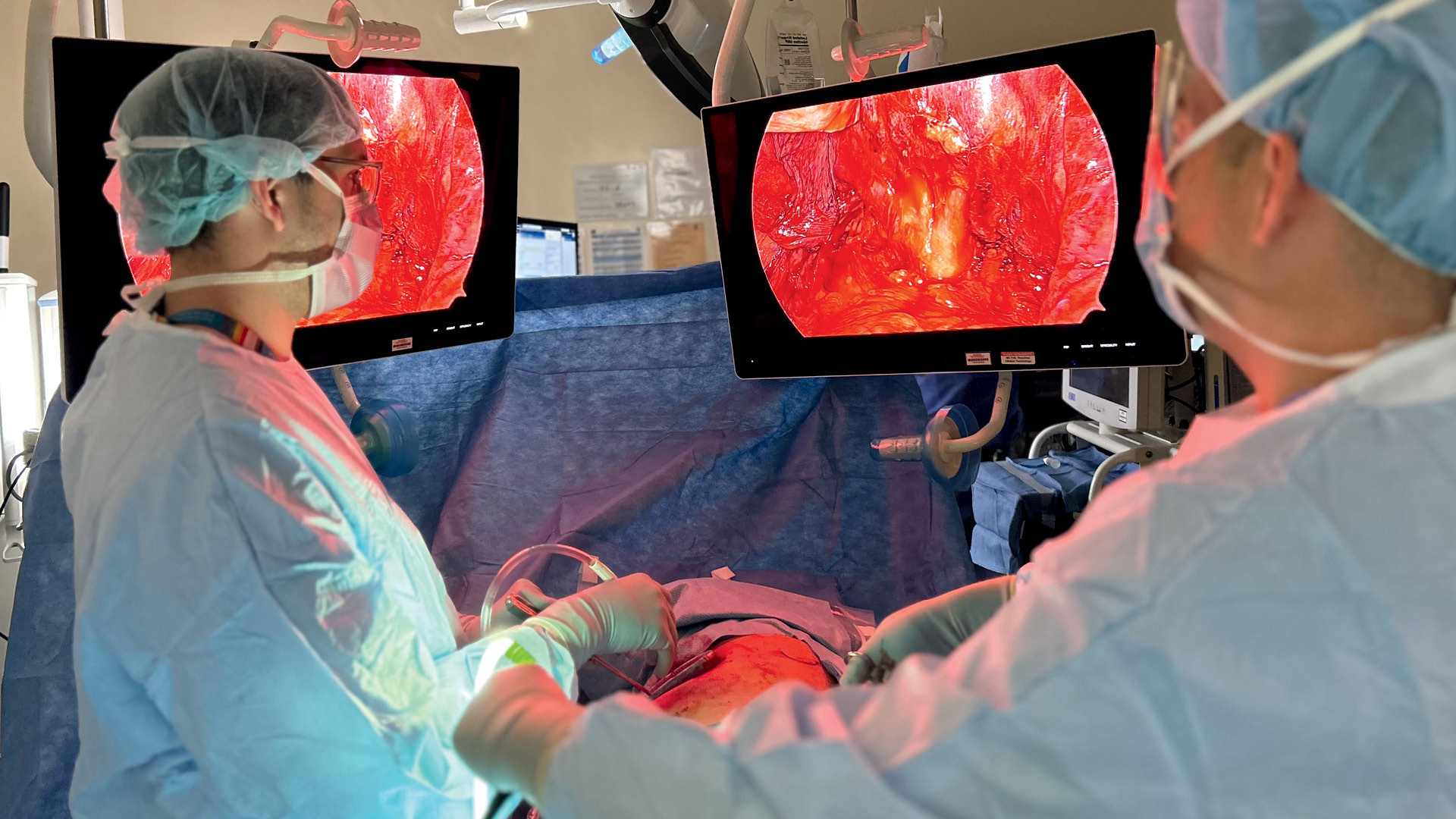 Timely Surgery for Early Stage Lung Cancer Matters