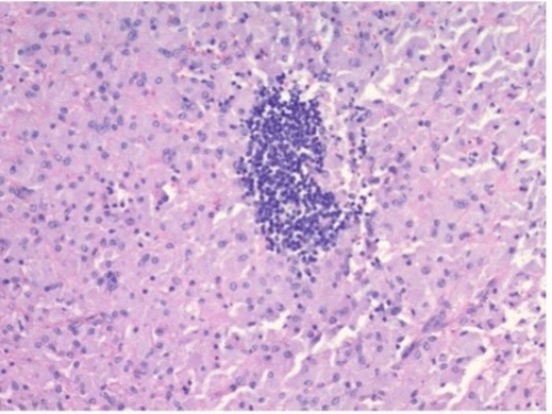 (A) Hematoxylin and eosin (H&E) stain, 10x magnification