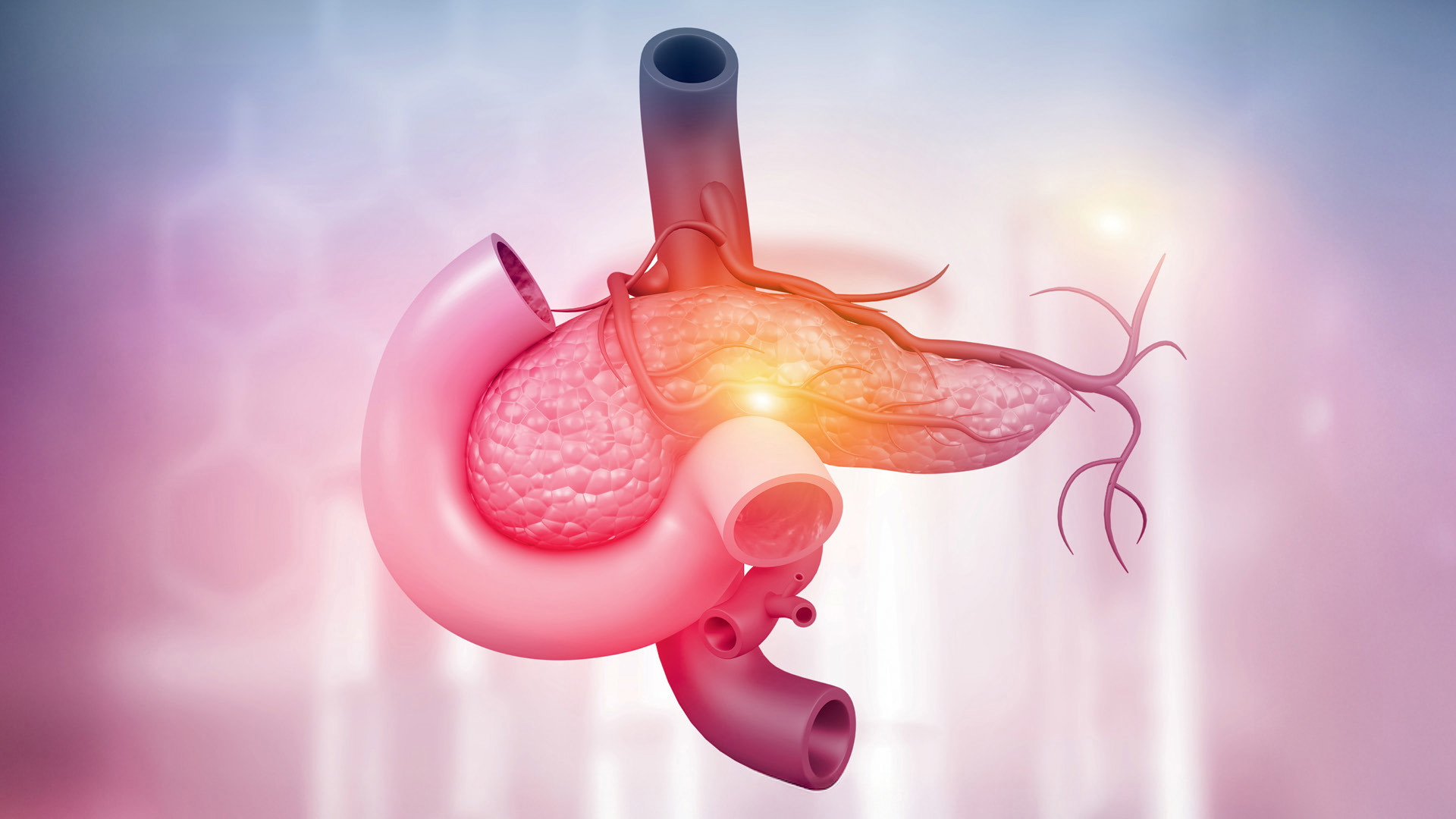 Pancreatic Cancer Treatment Is Changing for the Better