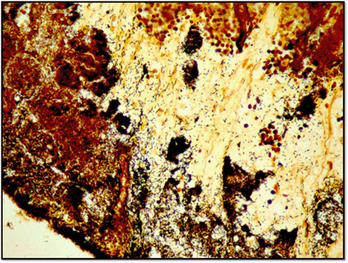 B) High power shows filamentous nature of actinomyces.
