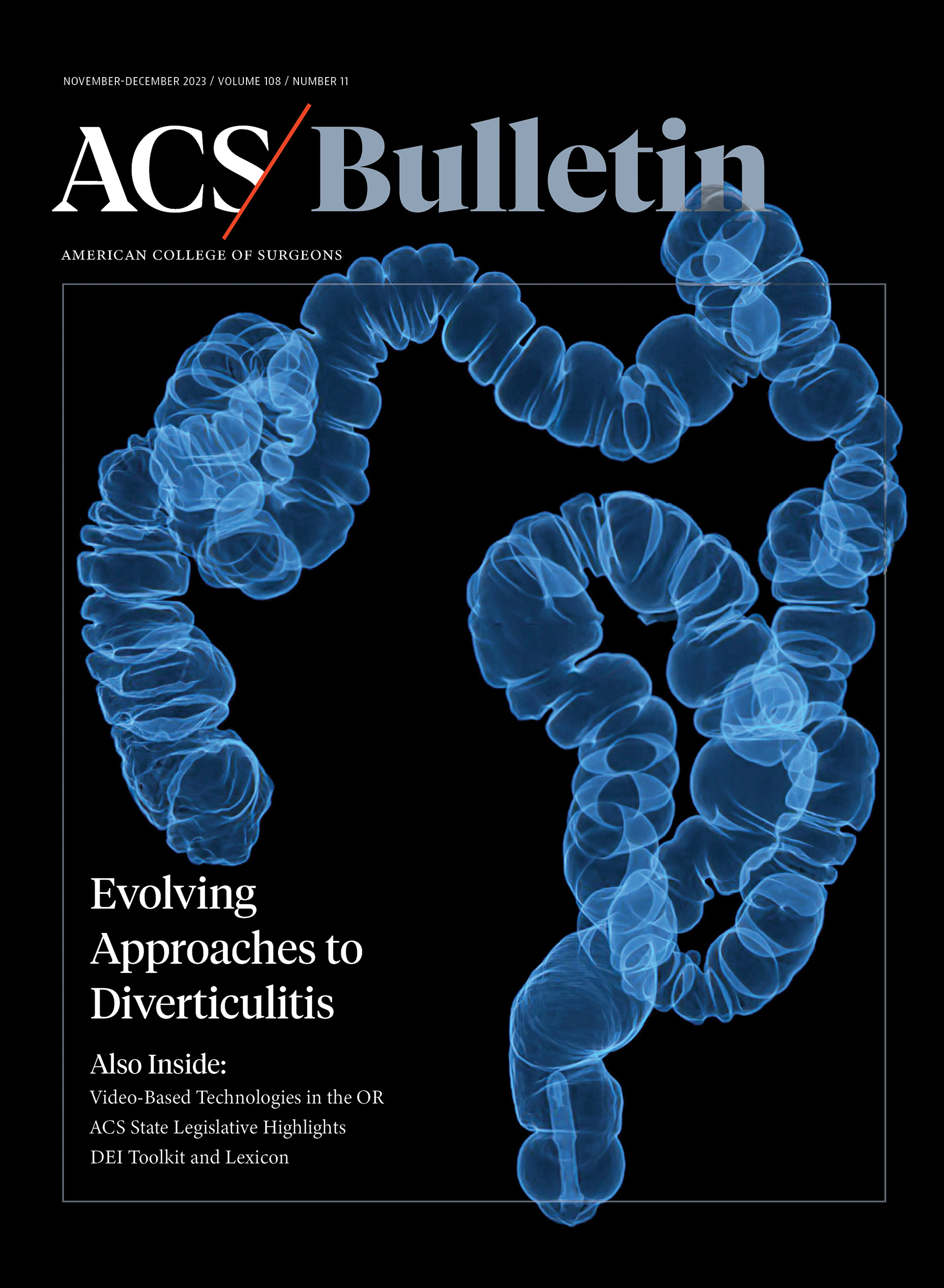 Top Bulletin Articles from 2023 Include Hernia Repair and Coding, Diverticulitis, and AI in Surgery