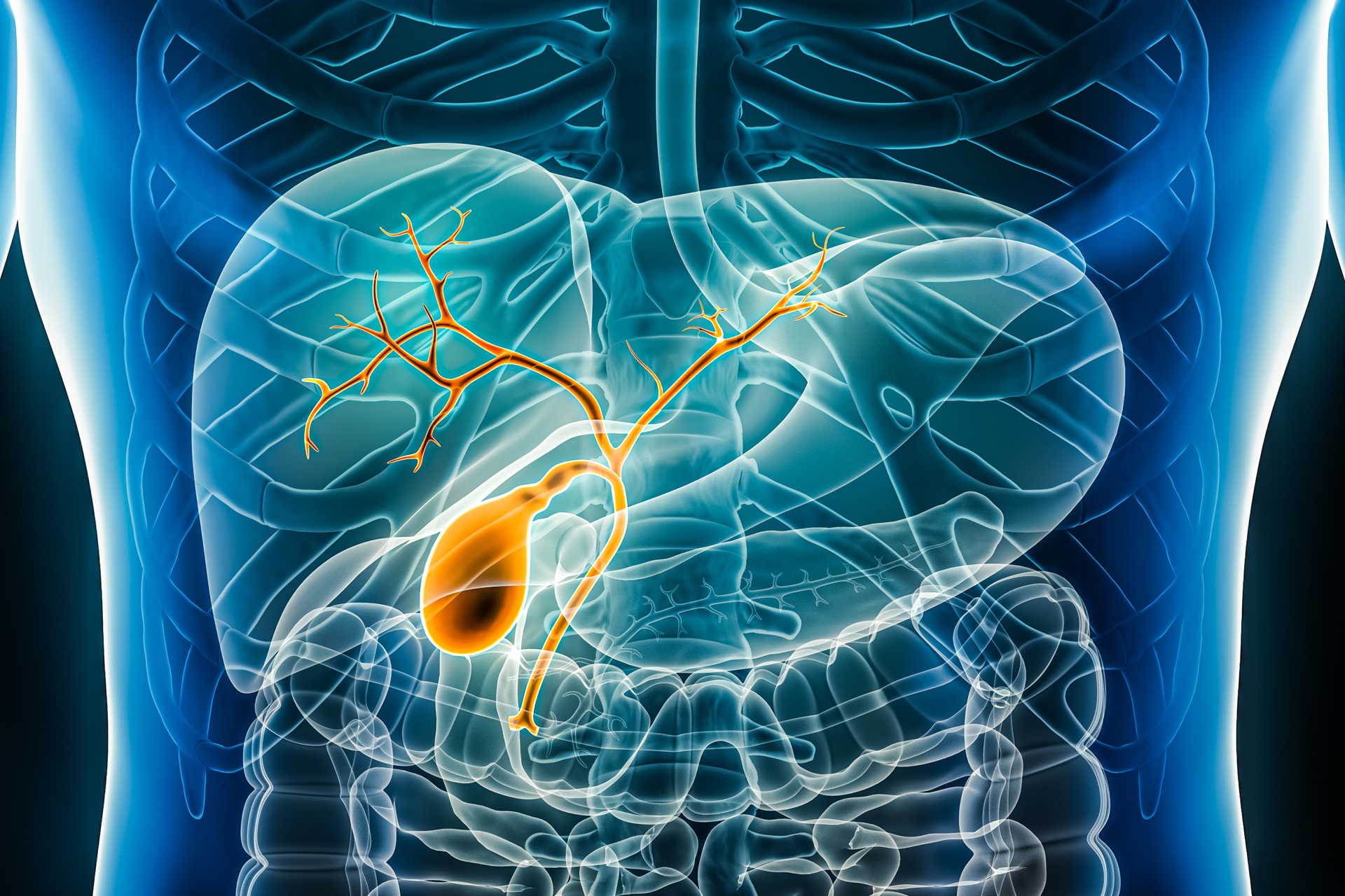 New Approaches Are Reshaping Common Bile Duct Stone Management