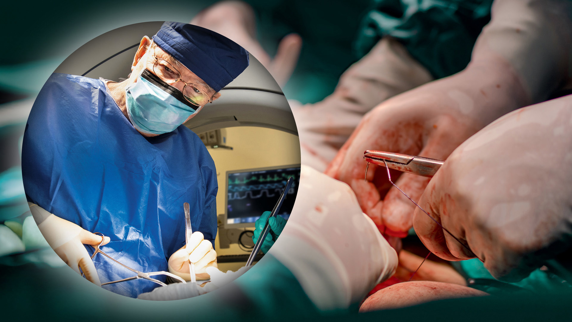 Surgeons Rethink Abdominal Trauma Playbook