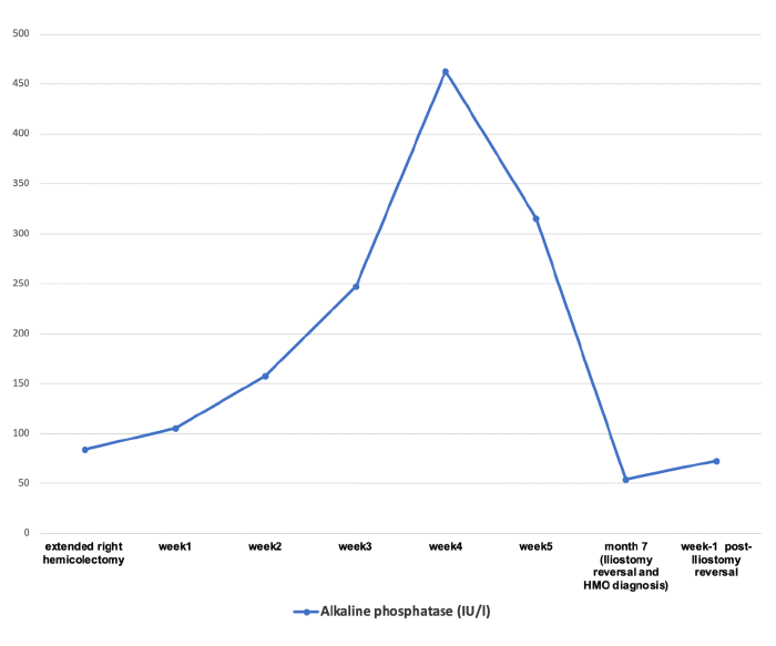 Note peak around the fourth week before progressive decrease until bone fragments identification and HMO diagnosis after seven months during an ileostomy reversal procedure