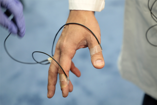 Surg Metric Slideshow1