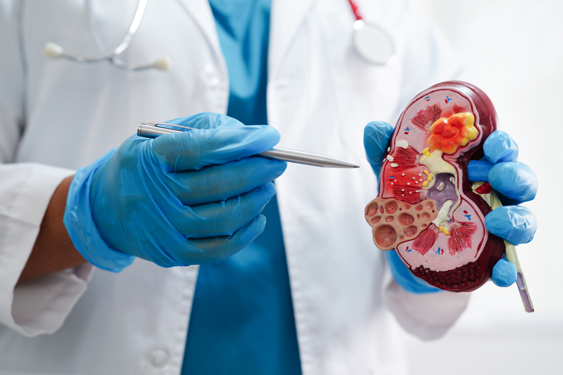 Despite Greater Transplantation Survival, Organ Shortages Persist