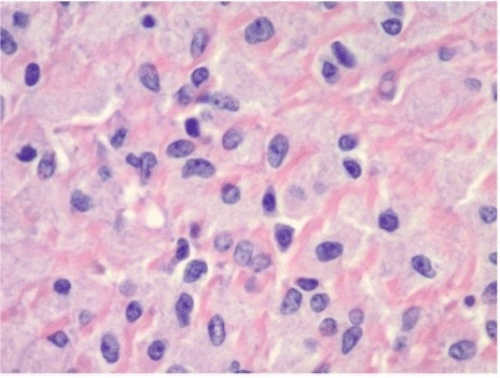 (B) H&E stain, 45x magnification