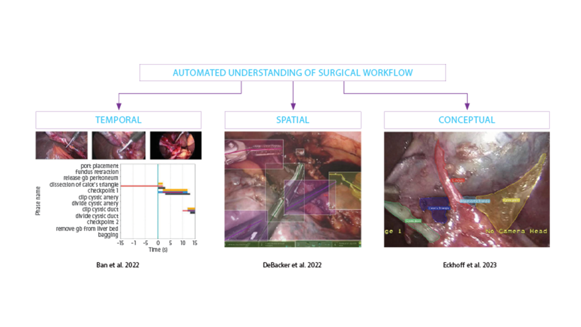Dr. Jennifer Eckhoff says that through comprehension of spatial, temporal, and conceptual aspects of surgical workflow, AI holds the potential to change minimally invasive surgery.