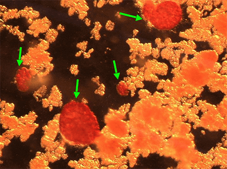Figure 3. Dithizone staining/40X. Green arrows are pointing to the unpurified autologous Islets.