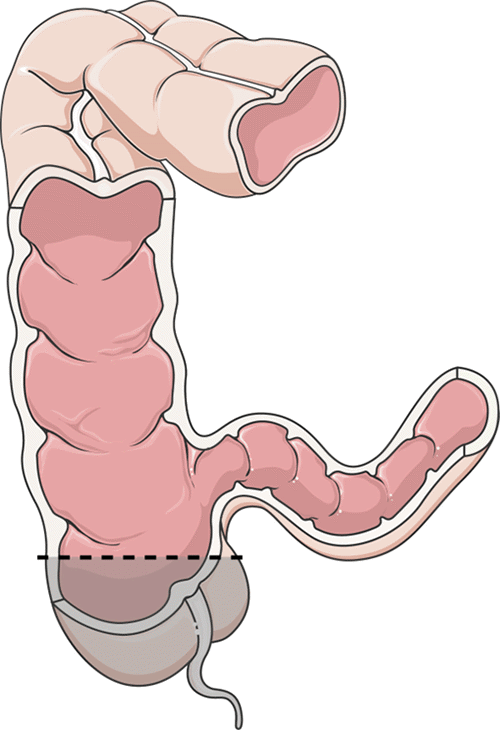 Figure modified by Michael J. Paolini, MD, from Servier Medical Art by Servier, licensed under a Creative Commons Attribution 3.0 Unported License