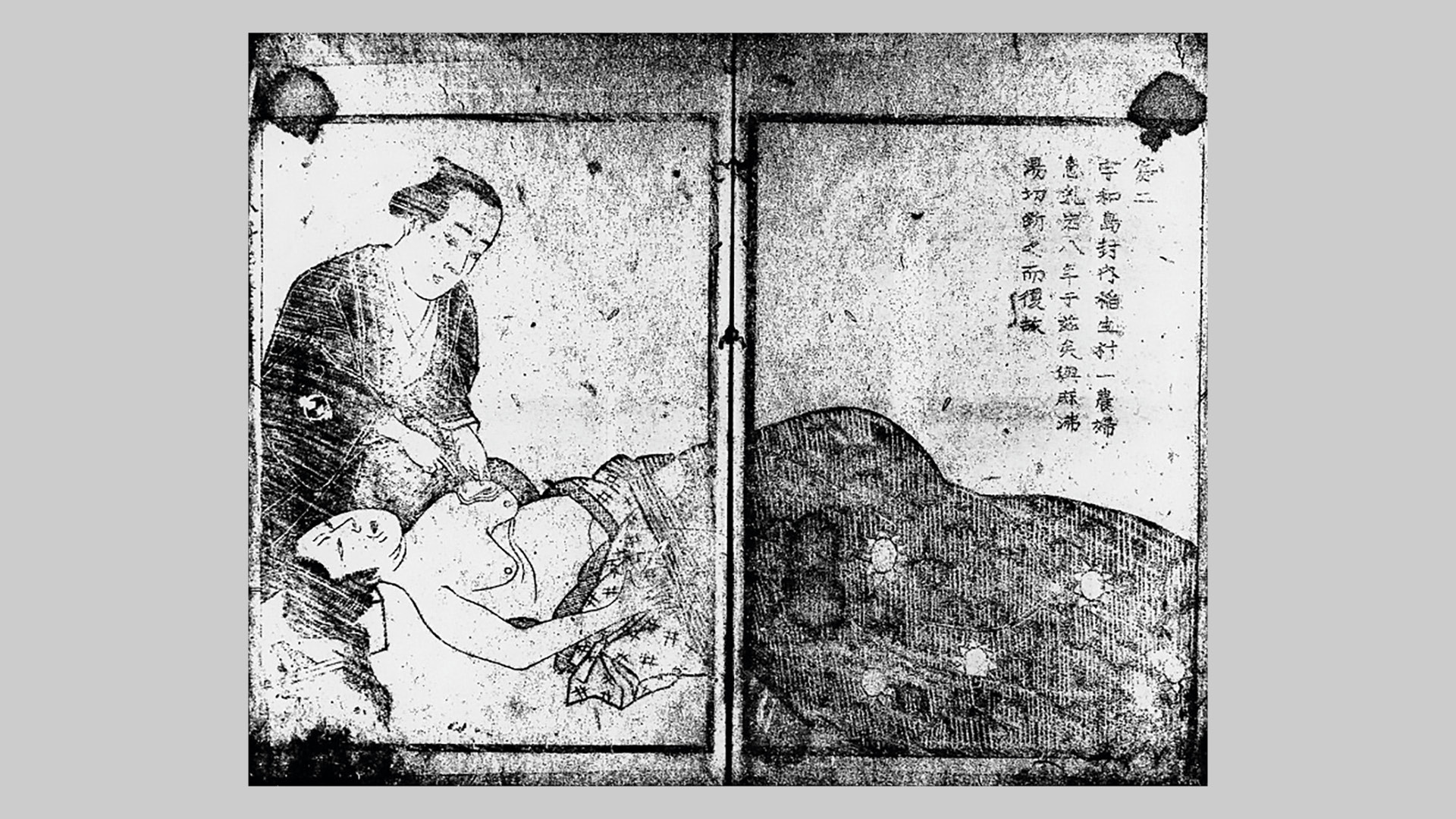 History of Anesthesia Begins with Ancient Herbal Mixtures