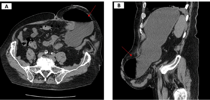 (A) Axial and (B) sagittal views 