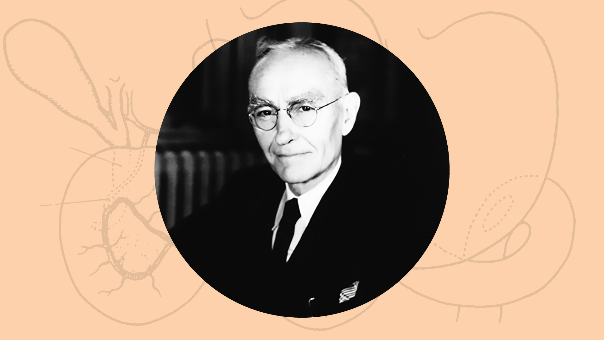 Whipple's Whipples: Insulinomas Changed the Course of Hepatopancreatobiliary Surgery