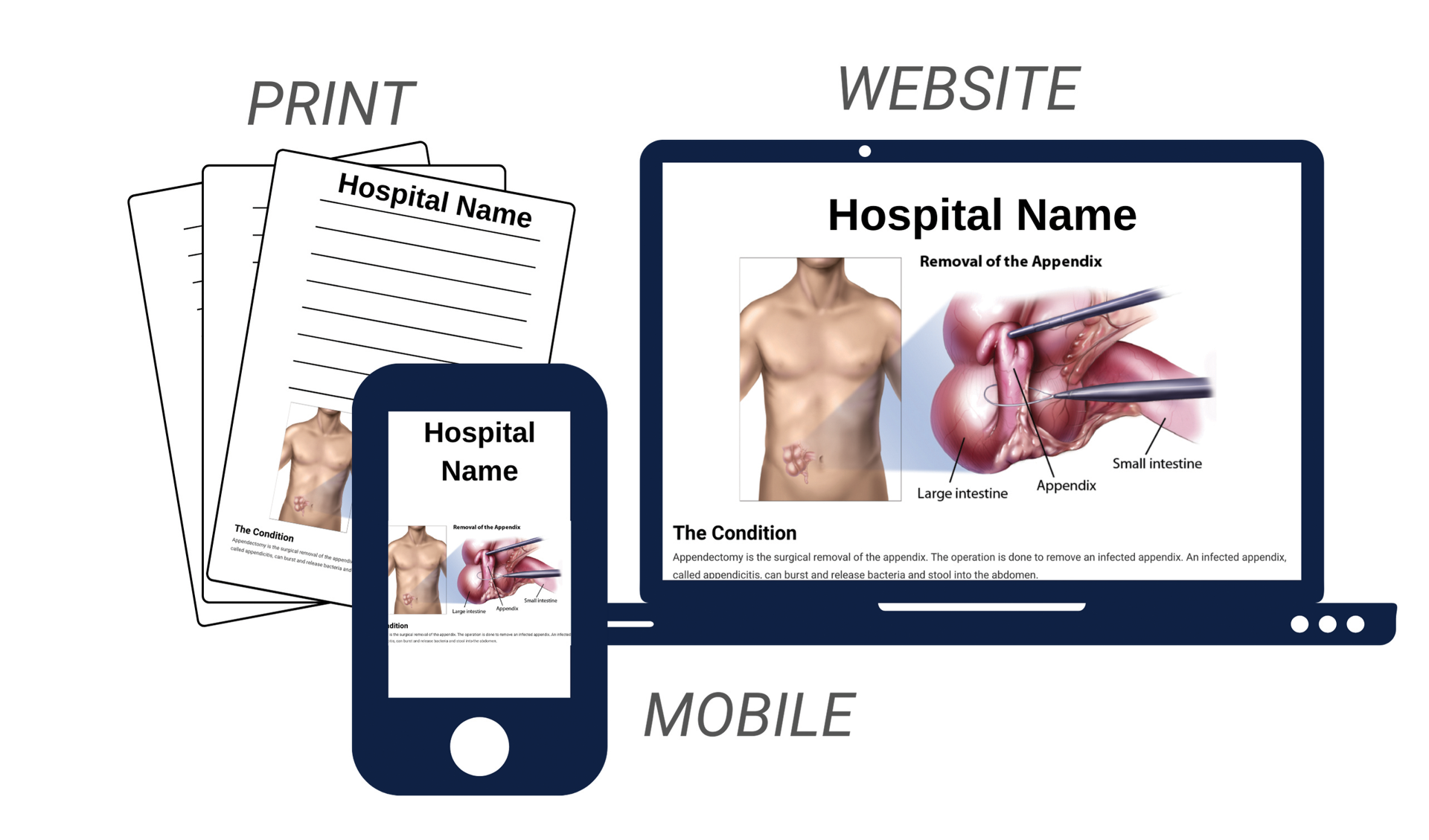 ACS Toolkit Provides Must-Have Surgical Patient Education Content