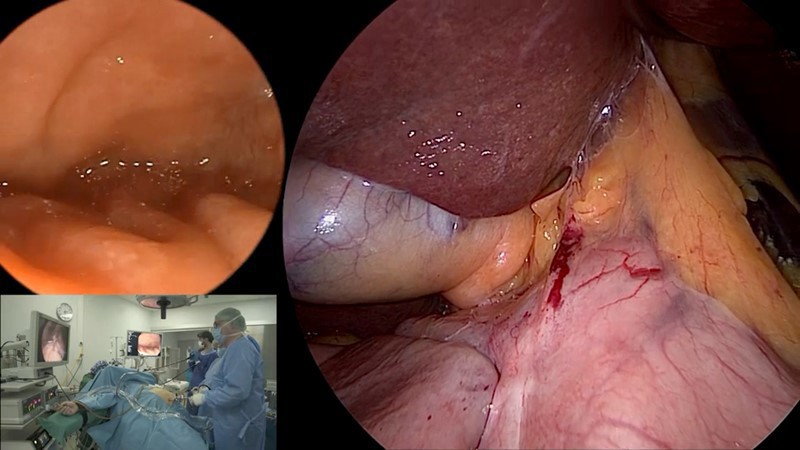 Fellow Leads Study on Innovative MagDI Bipartition for Safe, Effective Weight and T2D Reduction