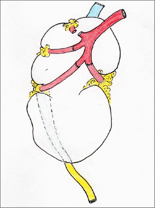 B) schematic (illustration by Niaz Ahmed)