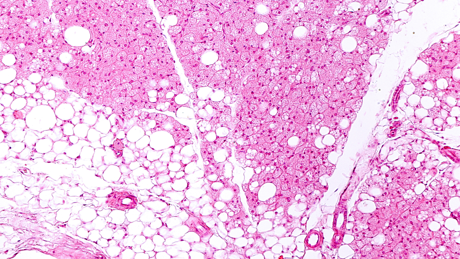 Study Clarifies Link between Obesity and Surgical Complications