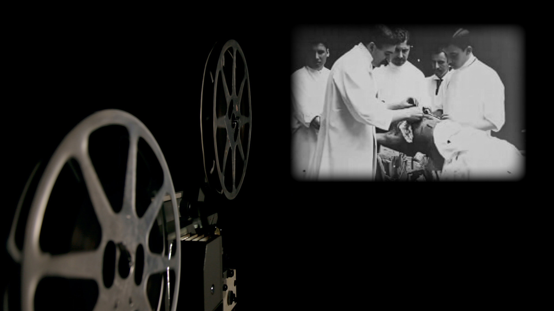 First Filmed Surgery Sparks New Era of Medical Cinema 