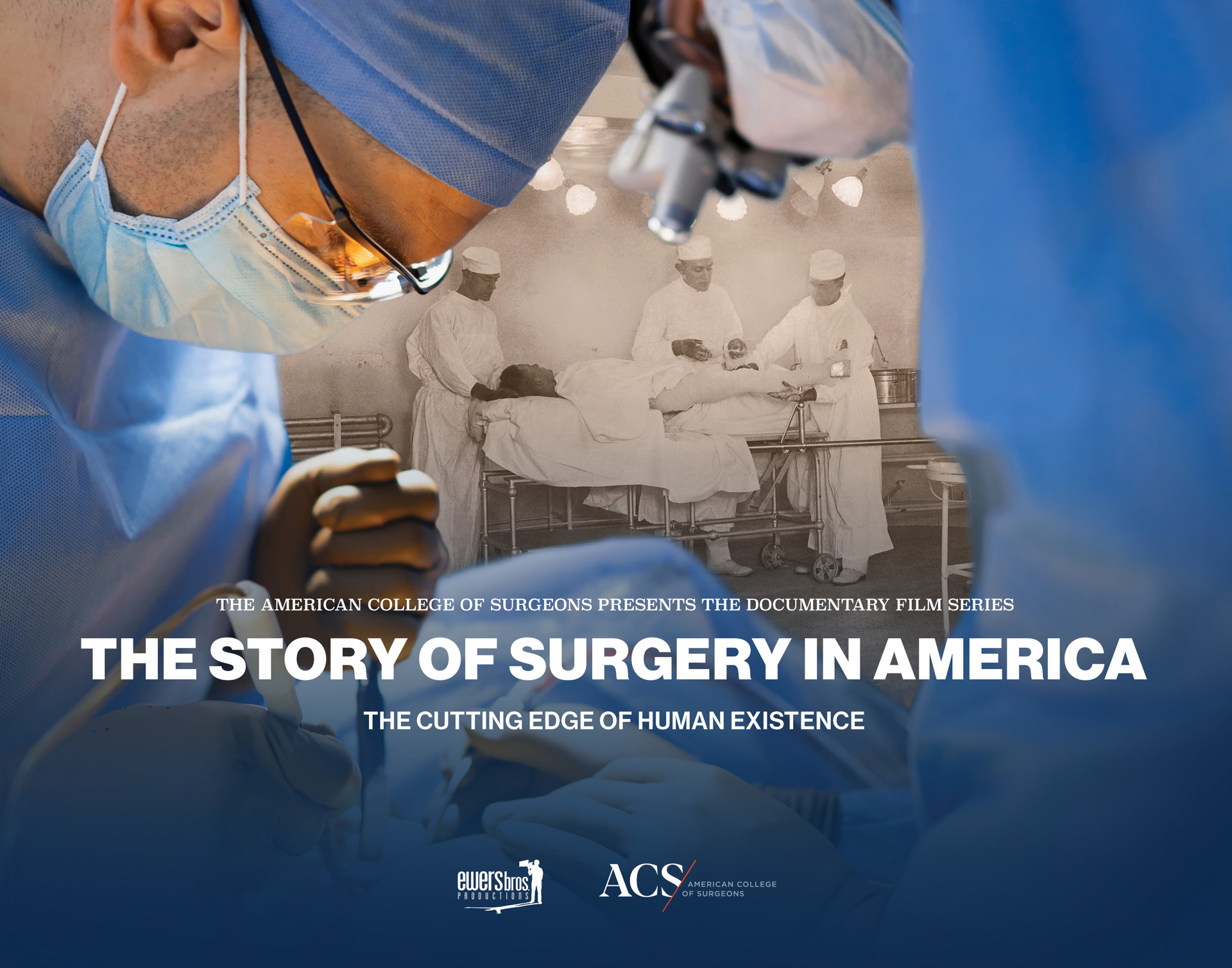 Story of American Surgery Film Project