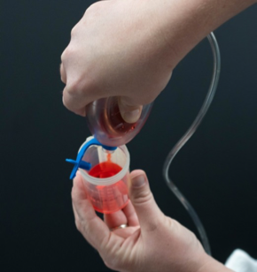 Turn the drain over and squeeze the drainage out into a cup.