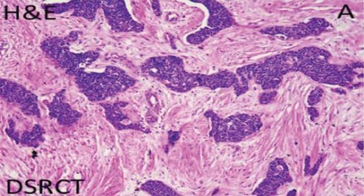 UT MD Anderson Cancer Center