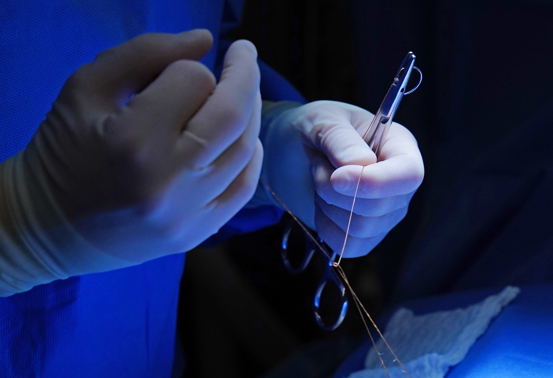 Fundamentals of Oncoplastic Breast Surgery